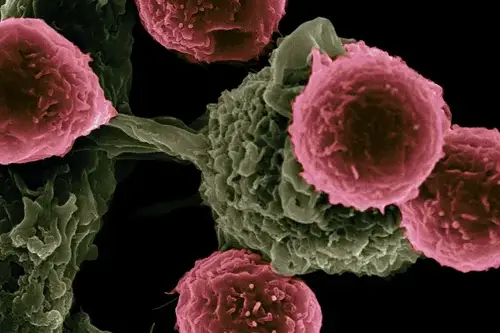 Cancer cells attacking normal cells